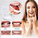 Вініри для верхніх зубів Snap On Smile, професійний, білий A-352 фото 2