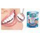 Знімні вініри Perfect Smile Veneers, вініри для зубів, накладні зуби, накладки для зубів 2260038 фото 2